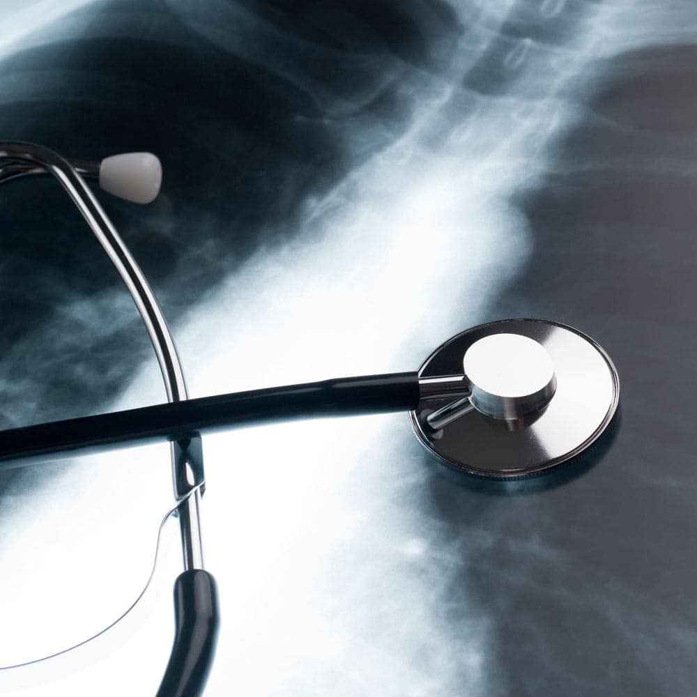 Global event raises awareness of chronic obstructive pulmonary disease