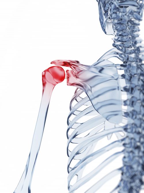 Eating to ease the pain of arthritis