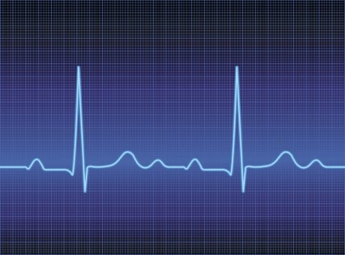 How does your heart health rate?