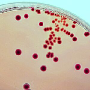 Call for participants for Auckland gut bacteria study