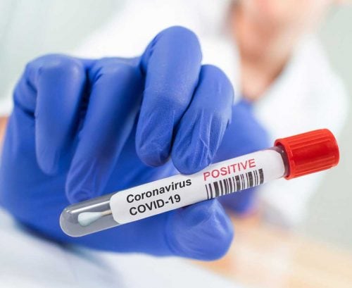 Lab person holding positive COVID test