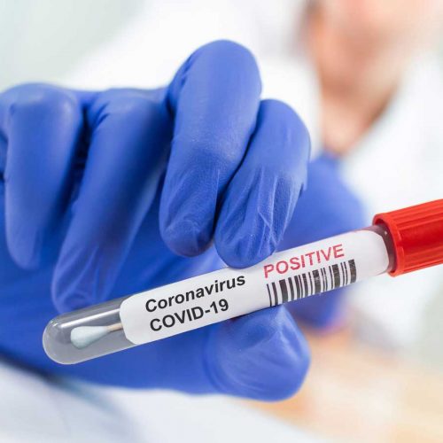 Can you get COVID-19 twice?