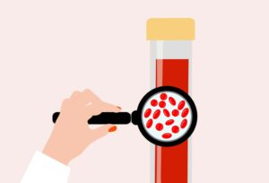 Ask the expert – What to eat if you have haemochromatosis